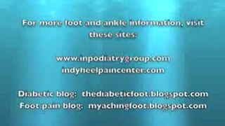 Turf Toe Injury- An Indianapolis Podiatrist Discusses This Common Sports Injury