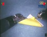 Robotik cerrahi Ameliyatı - Koru Hastanesi www.koruhastanesi.com
