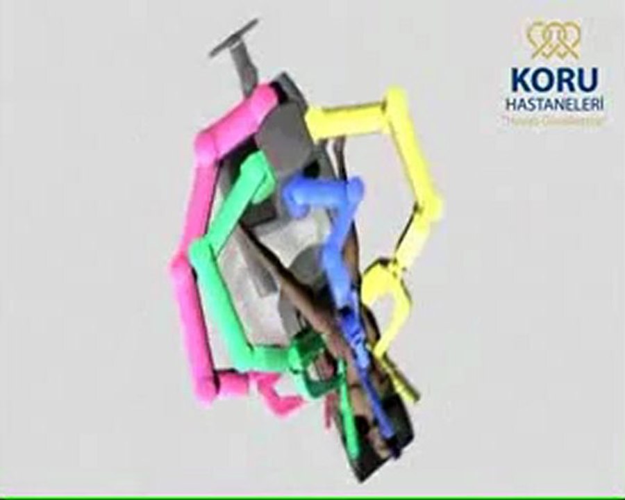 Ankara Robotik Cerrahi - Koru Hastanesi +90-312-287-9797