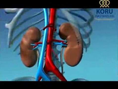 Böbrek kanserinde Robotik Cerrahi Ameliyatı - Koru Hastanesi +90-312-287-9797
