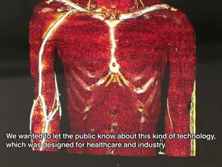 Print a 3D model of your unborn child