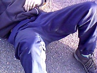 mal de couilles !!!!!