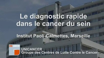 Le diagnostic rapide dans le cancer du sein à l'IPC