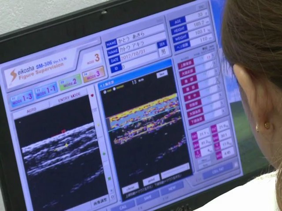 Verboten dick? Japan kämpft per Gesetz gegen Übergewicht