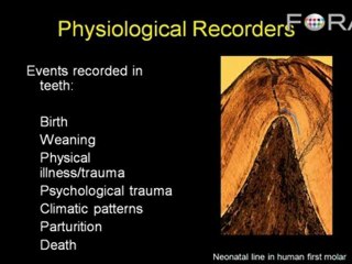 Dental Discoveries: Teeth Contain Growth Rings Like Trees