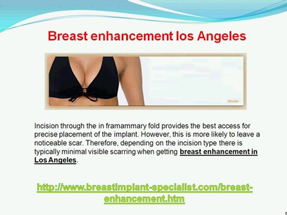 Breast Implants in Beverly Hills – Get Your Best Figure