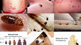 Bed Bugs Natural Treatment, Get Rid of Bed Bugs Permantly Secrets Reveal