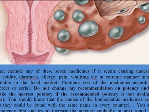 Polycystic ovary syndrome (PCOS) and its homeopathic cure Dr Bashir Mahmud Ellias