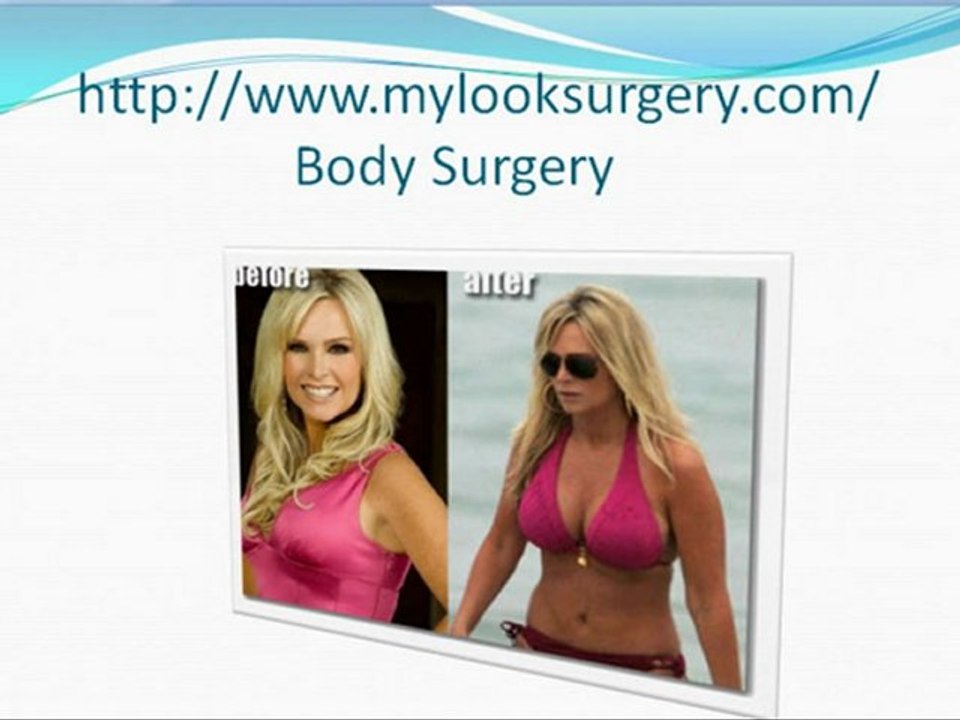 Gain confidence through Breast Implant surgery