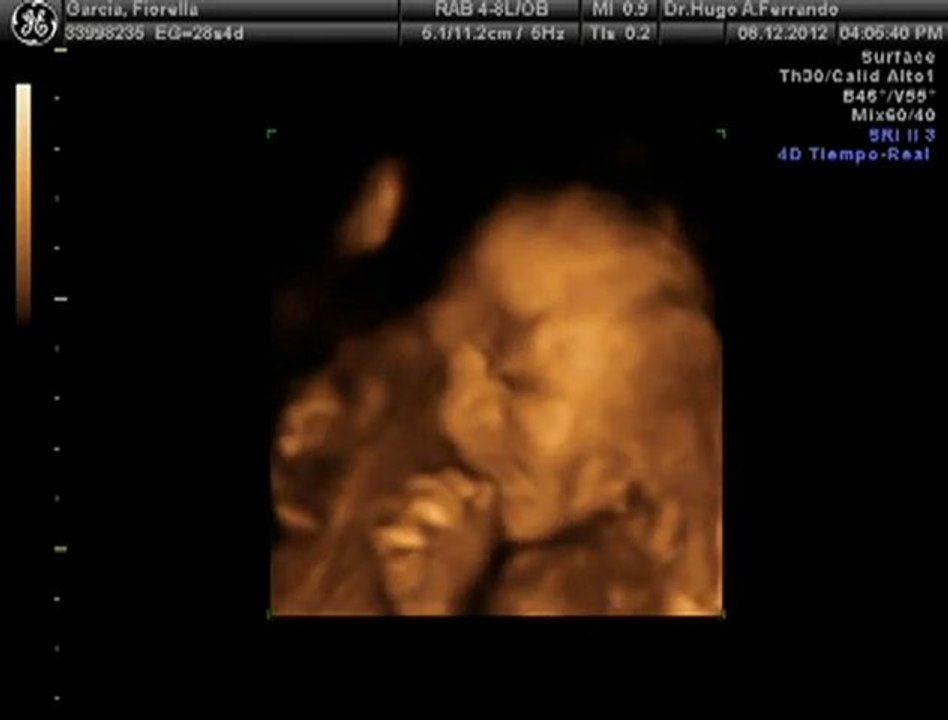 isabella dic2012 4d
