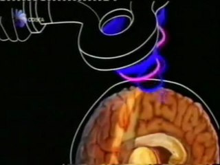 Estimulacion magnetica transcraneal (TMS): Electromagnetismo cerebral