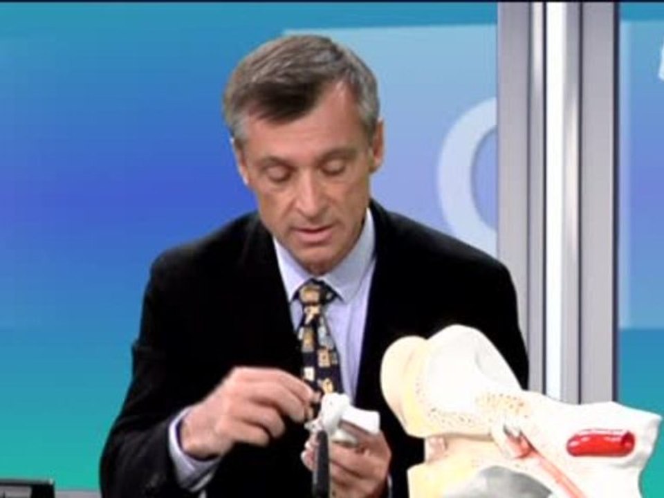 C La Santé : La Surdité et les implants cochléaires