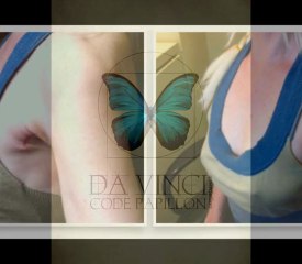 LA THYROIDE ET LA ROBOTIQUE