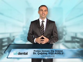 Ortodonti Tedavisi -  Çağdaş Kışlaoğlu Haberdesin.com