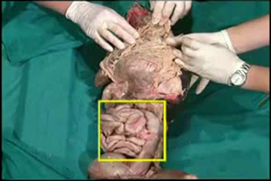 anatomia veterinaria - cavidad abdominal 3