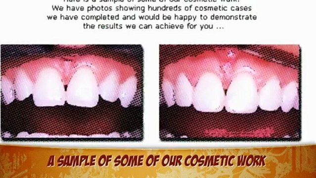 Dentists Implants Costa Mesa Veneers Dentures Cosmetic Dentistry Invisalign Dental Services