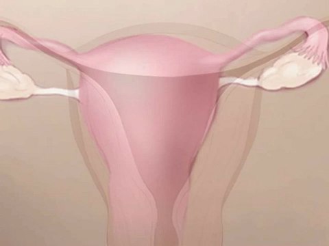 ד ר אילון לחמן - כל מה שצריך לדעת על אמצעי מניעת הריון קבוע