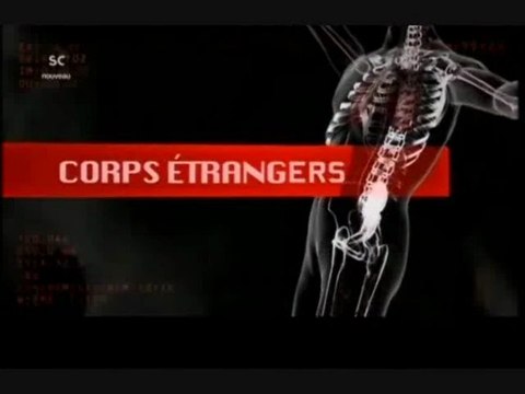 Corps étrangers [ Poursuites léthales ]