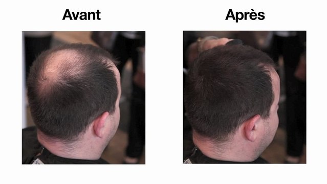 HairMaker - Poudre pour cheveux - Masquer calvitie