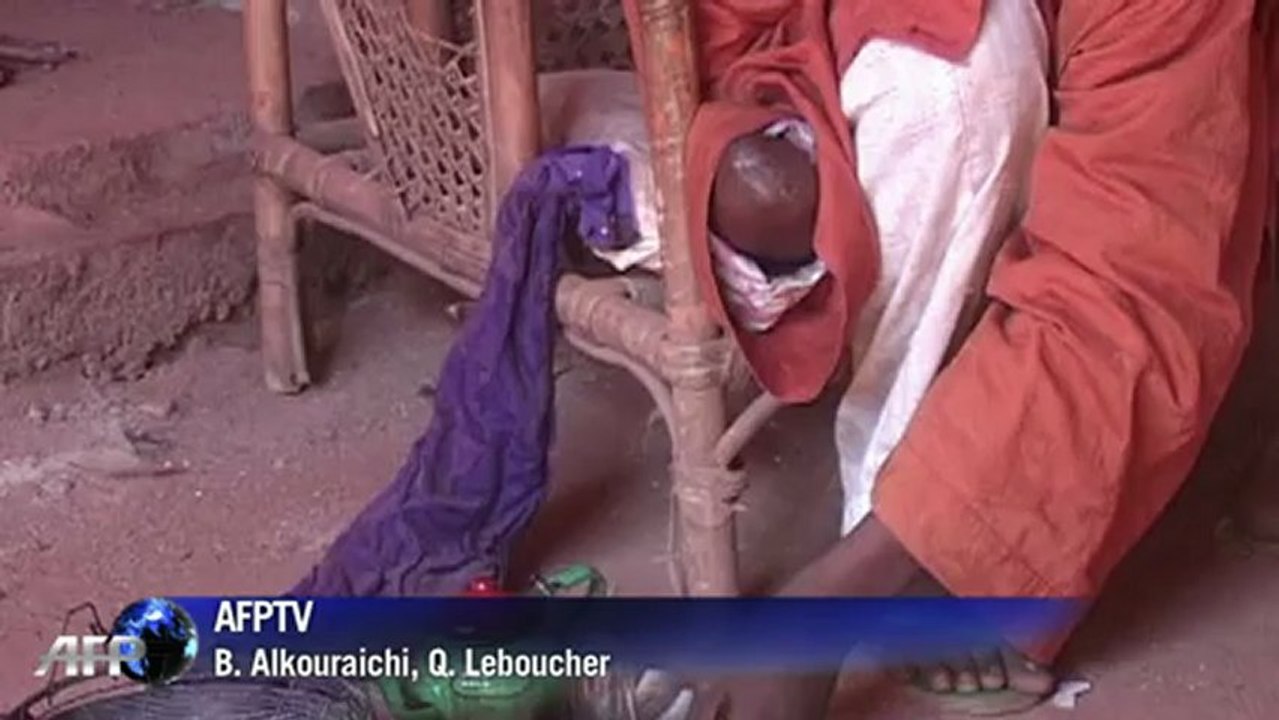 Mali: Moctar et Souleymane, amputés par les islamistes