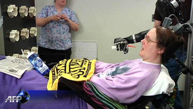 Mind-controlled hand offers hope for the paralysed