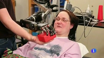 Brazo bionico: Interfaz cerebro-maquina