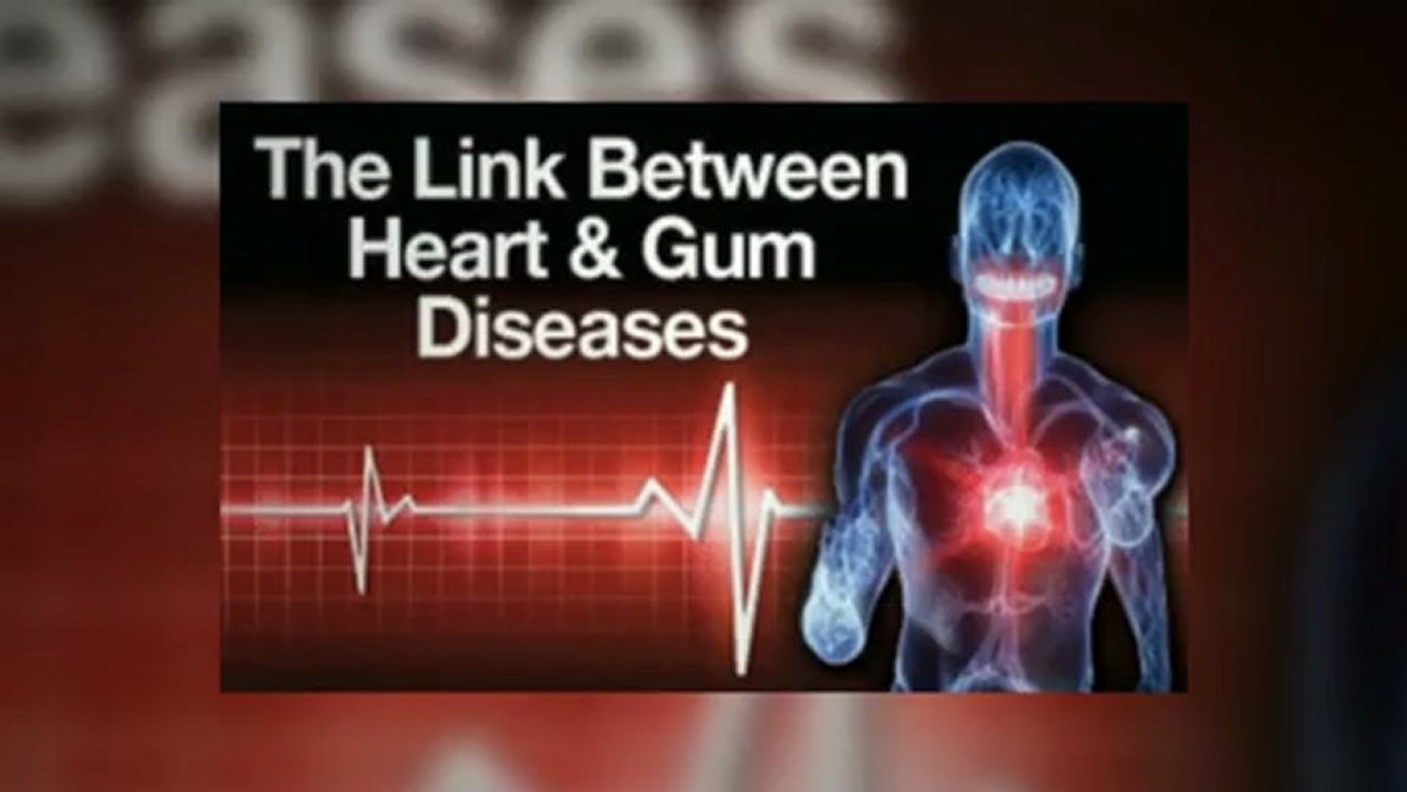 Laser Gum Surgery LANAP in Los Angeles Ca Reverse Gingivitis Periodontitis with a Laser