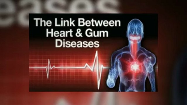 Laser Gum Surgery LANAP in Los Angeles Ca Reverse Gingivitis Periodontitis with a Laser