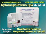 CMV IgG ELISA kit