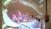 Cirurgiões fazem transplante conjunto de fígado e coração