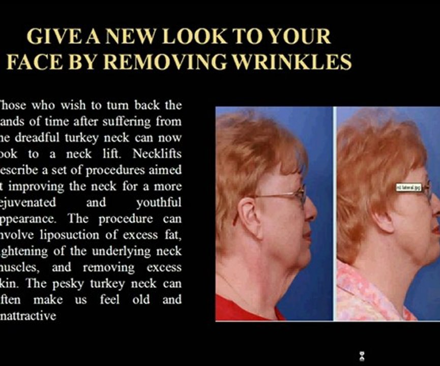 GEt plastic surgery done and look beautiful