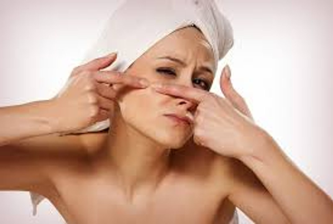 Acne Cures: Is there a Natural Acne Cure that Works?