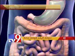 Delhi gang-rape victim needs Intestine transplantation