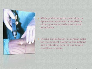 Enhance Your Body Through Contouring Procedure