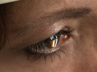 What Are The Long Term Risks Of LASIK?