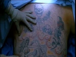 Nip tuck saison 1 (opération la toya)