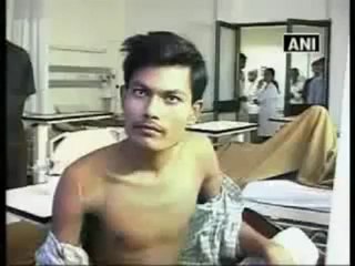 Surgeons remove six-feet iron rod from a man's body.mp4