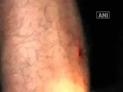 Two train passengers injured in firing by Maoists in WB.mp4