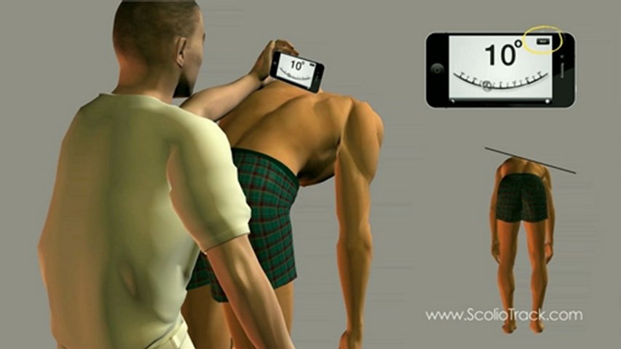 So benutzt man Scolio-Track -- eine detaillierte Anleitung; Bedienungsanleitung und Demonstration.