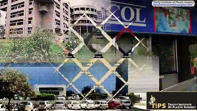 Tricity Institute of Plastic Surgery (TIPS), the One- Stop for All Cosmetic & Plastic Surgeries