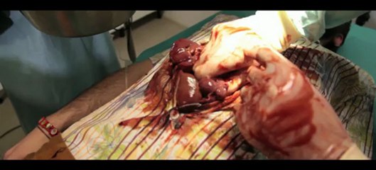 Fil rouge Kino Session #34