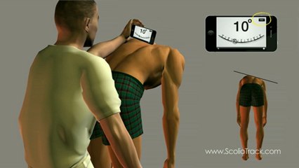 Cómo utilizar ScolioTrack - Instrucción detallada para el usuario; Tutorial demostrativo