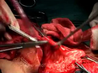 Medicine-mdv-478-19.flv