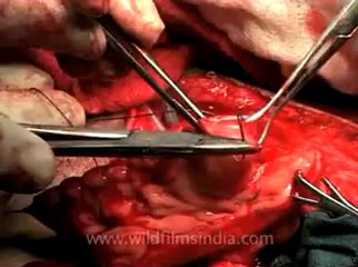 Medicine-mdv-478-34.flv