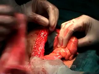Medicine-mdv-478-8.flv