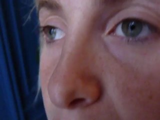 rhinoplastie avant apres, par voie fermée, vladimir mitz