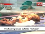 His heart pumps outside his body!.mp4