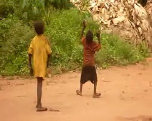 Quand la maladie du pian ronge les enfants pygmées_1