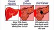 Ayurvedic Remedies Reviews:Home Remedies For Liver Cirrhosis Pain Treatment