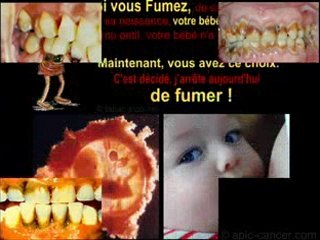 "Fumer tue"... Ca vous fait quoi ?